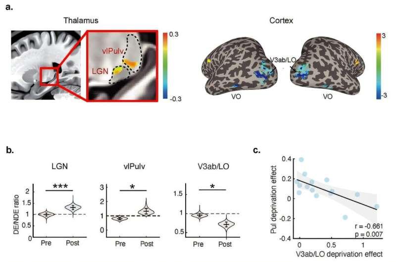 Dual mechanisms drive rapid eye dominance plasticity in the adult brain ...